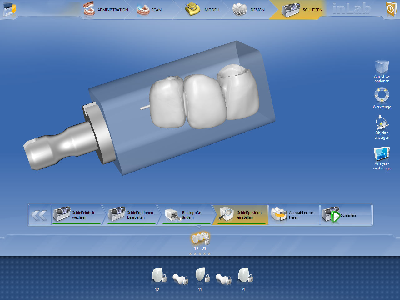 CEREC-Montorbild: Die Position des Zahnersatzes im Block.